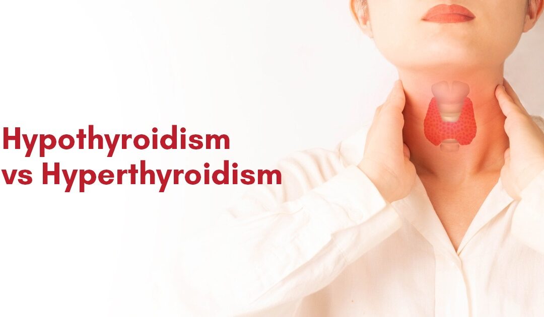 Hypothyroidism vs Hyperthyroidism