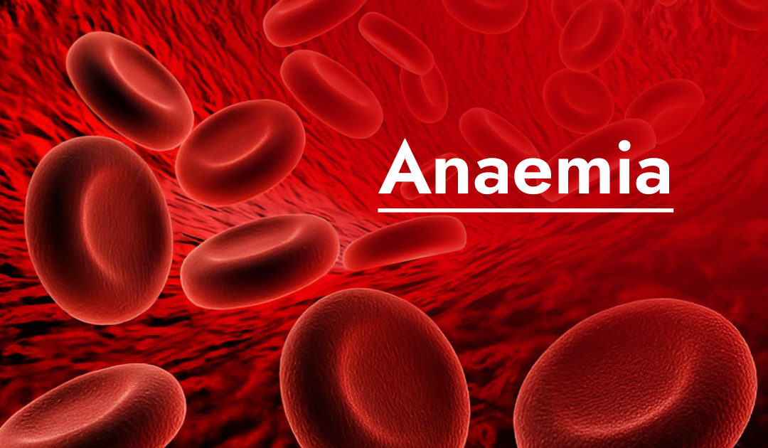 Anemia